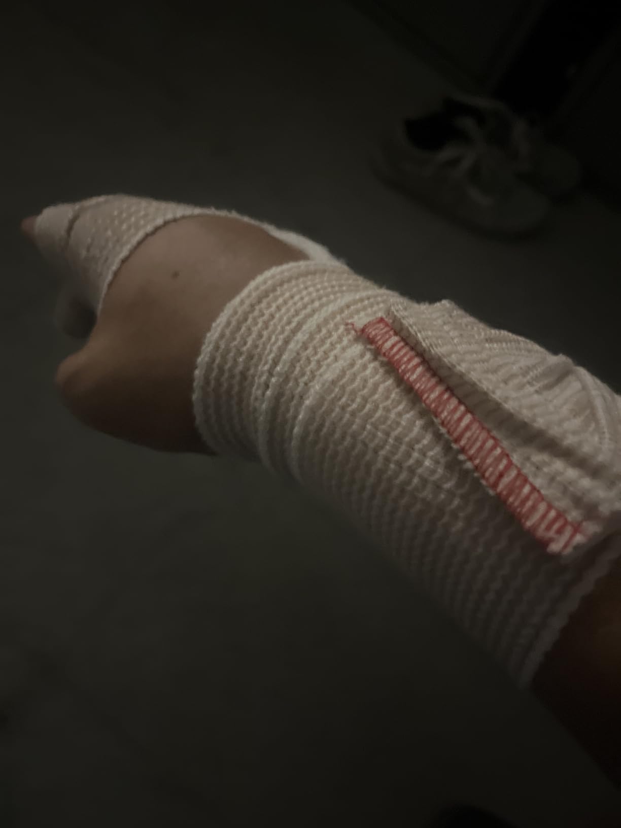ace bandage